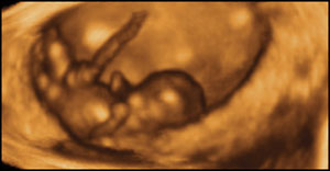 Dupa o gestatie de 8 saptamani, acest fetus este capabil sa loveasca si sa-si stranga picioarele, sa le miste intr-o parte si-n alta, si sa-si miste bratele in sus si-n jos.