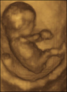 Dupa o gestatie de 10 septamani, acest fetus poate sa-si miste mainile si picioarele intr-o serie de miscari dinamice si foarte flexibile.