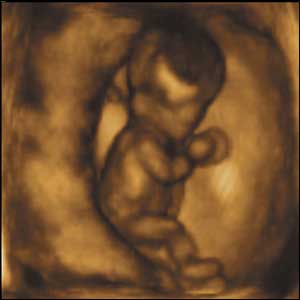 Acest fetus arata acelasi comportament cu cel de dupa nastere. Daca este tinut in pozitie verticala pe o suprafata plana el va incerca sa mearga inainte.