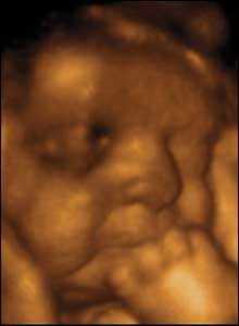 Fetusii de 11 saptamani au fost vazuti cu degetele in gura. Acest bebelus a inceput sa-si suga degetul mic de la picior, si gradual el va trece la unul si mai mare si mai bun.
