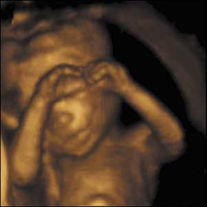 Creierul acestui bebelus s-a dezvoltat suficient de mult pentru a putea simti celelalte membre ale corpului. Bebelusul isi poate atinge varfurile degetelor.